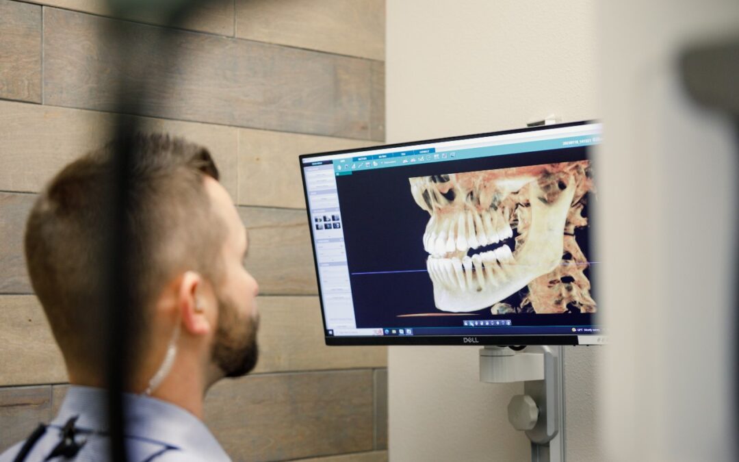 How Often Do I Need X-Rays at the Dentist?