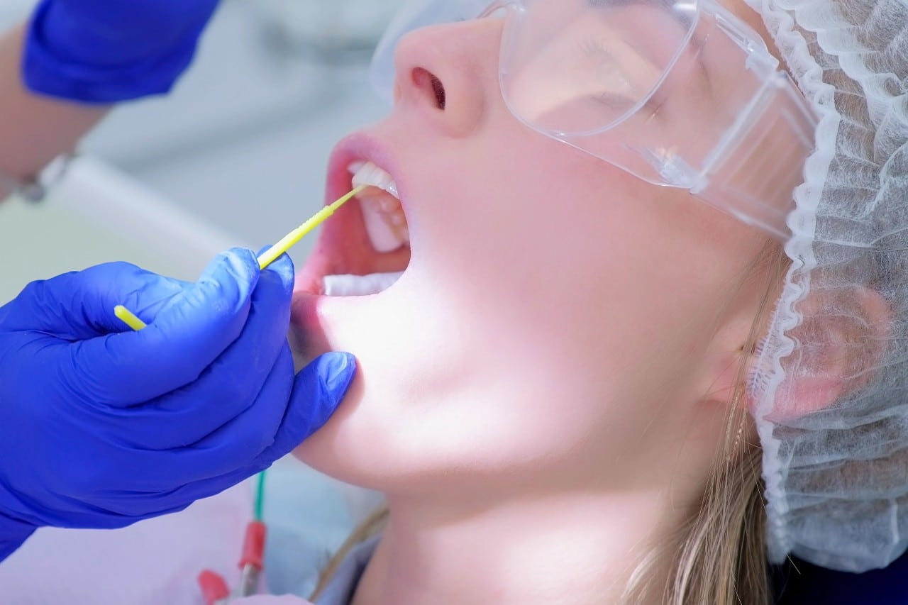 fluoride treatment by Creekside Dental