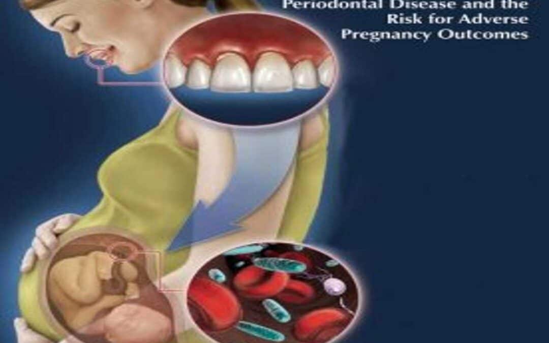 Is periodontal disease (gum disease) dangerous during pregnancy?