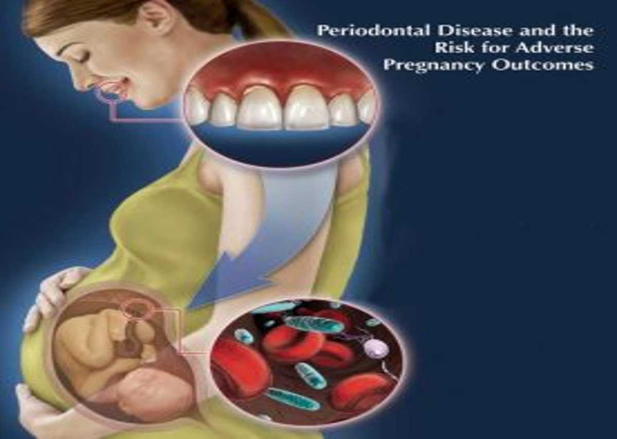 periodontal disease during pregnancy Creekside Dental