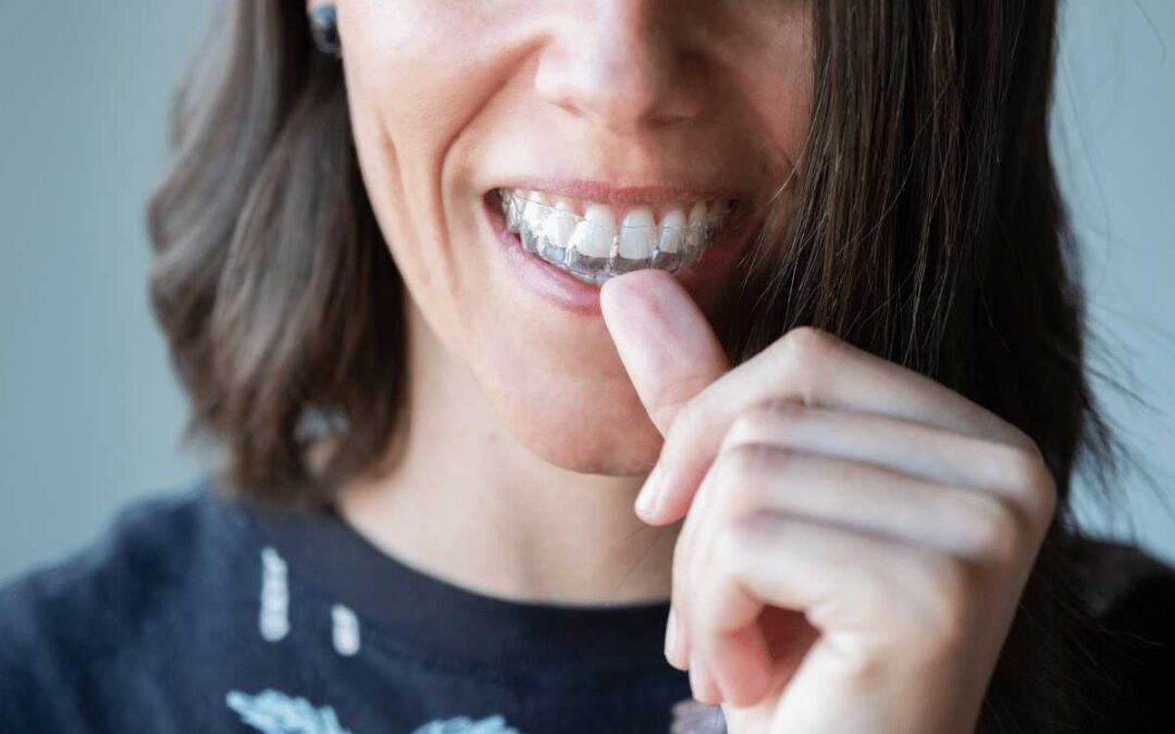 Straighten Your Teeth With Invisalign Braces