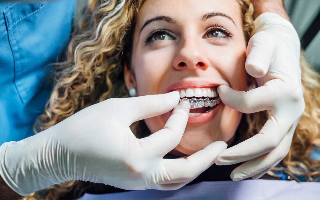10 Things You Should Know About Invisalign Before Starting Treatment