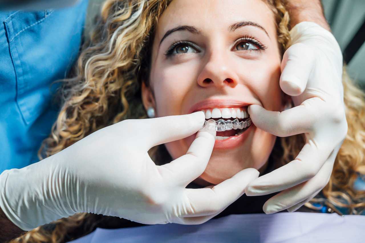 dentist doing invisalign treatment on patient Creekside Dental