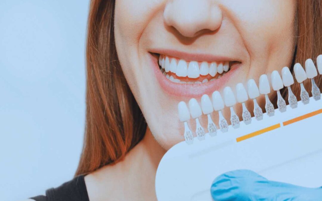 The Pros and Cons of Professional Teeth Whitening 