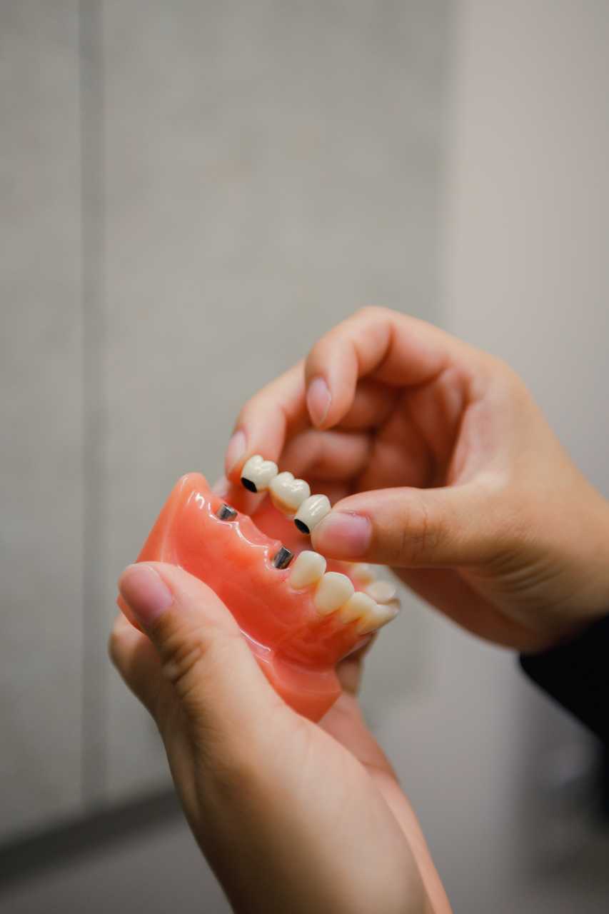 crown repair sample on tooth Creekside Dental