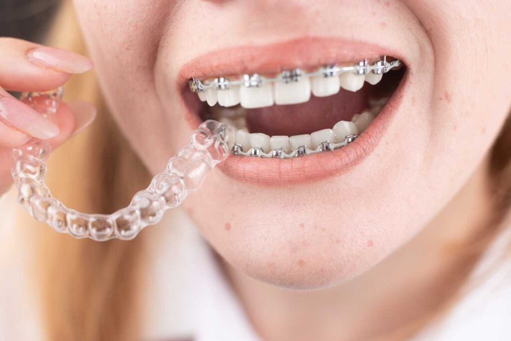 woman with braces holding an invisalign Creekside Dental