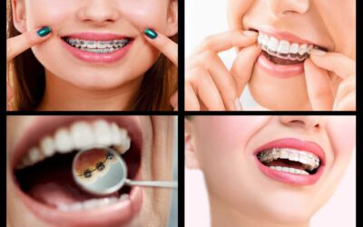 The Different Types of Braces: Which Option is Right for You and Your Dental Needs