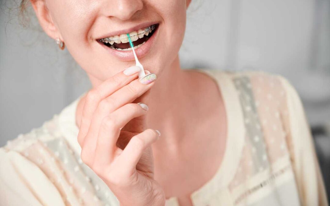 How to Care for Your Braces and Maintain Good Oral Hygiene