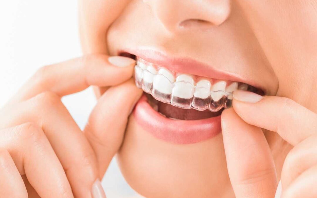 Maintaining Oral Health with Invisalign: Tips and Best Practices