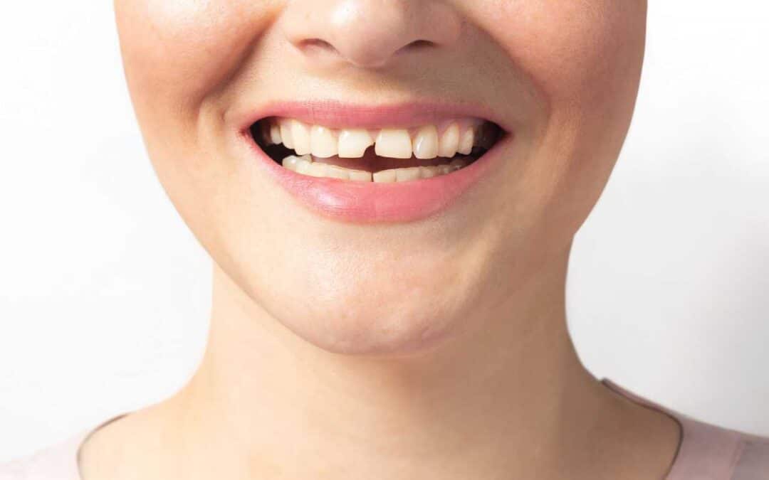 Emergency Dental Care in Kennewick: What to Know and Where to Go