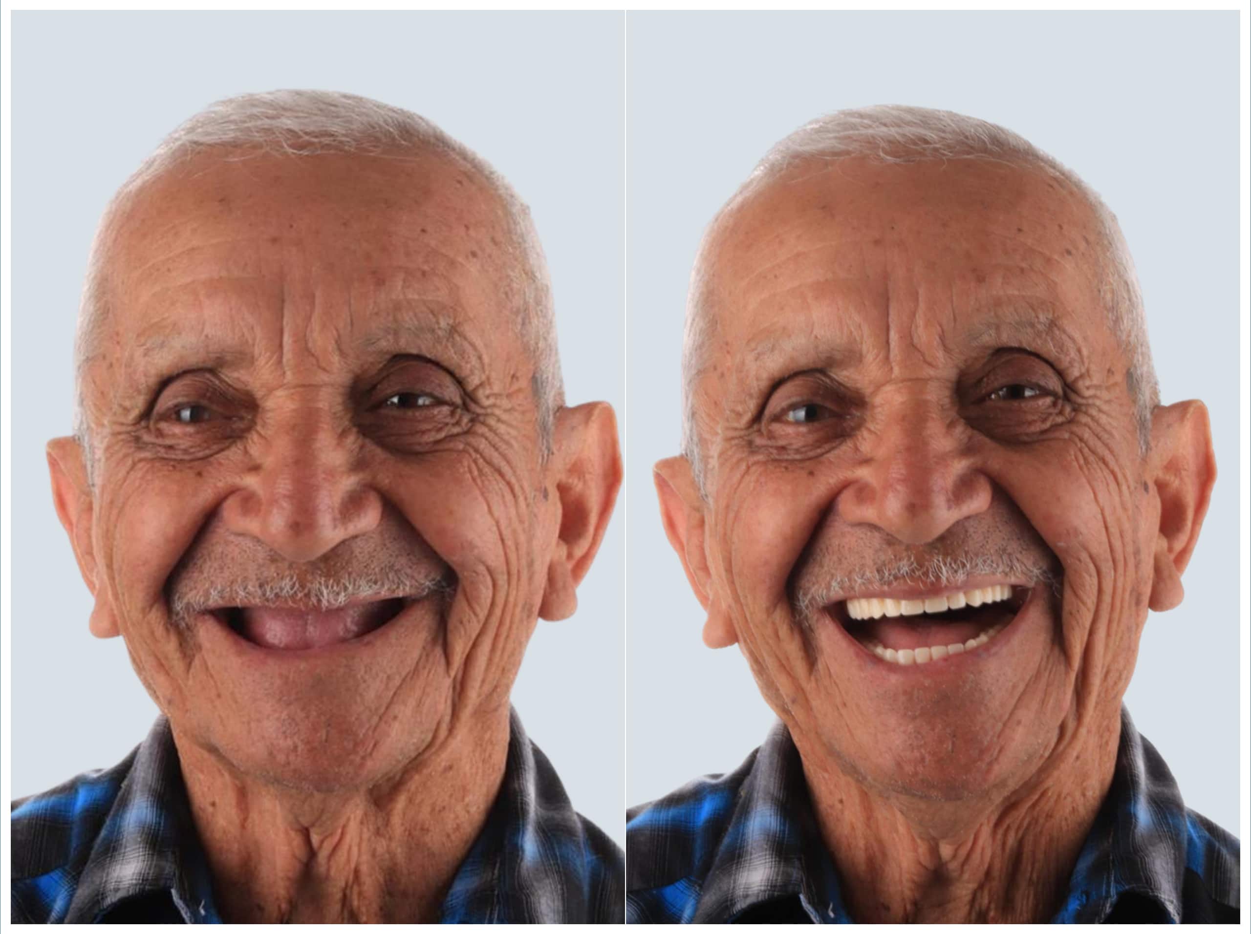 before and after (1)