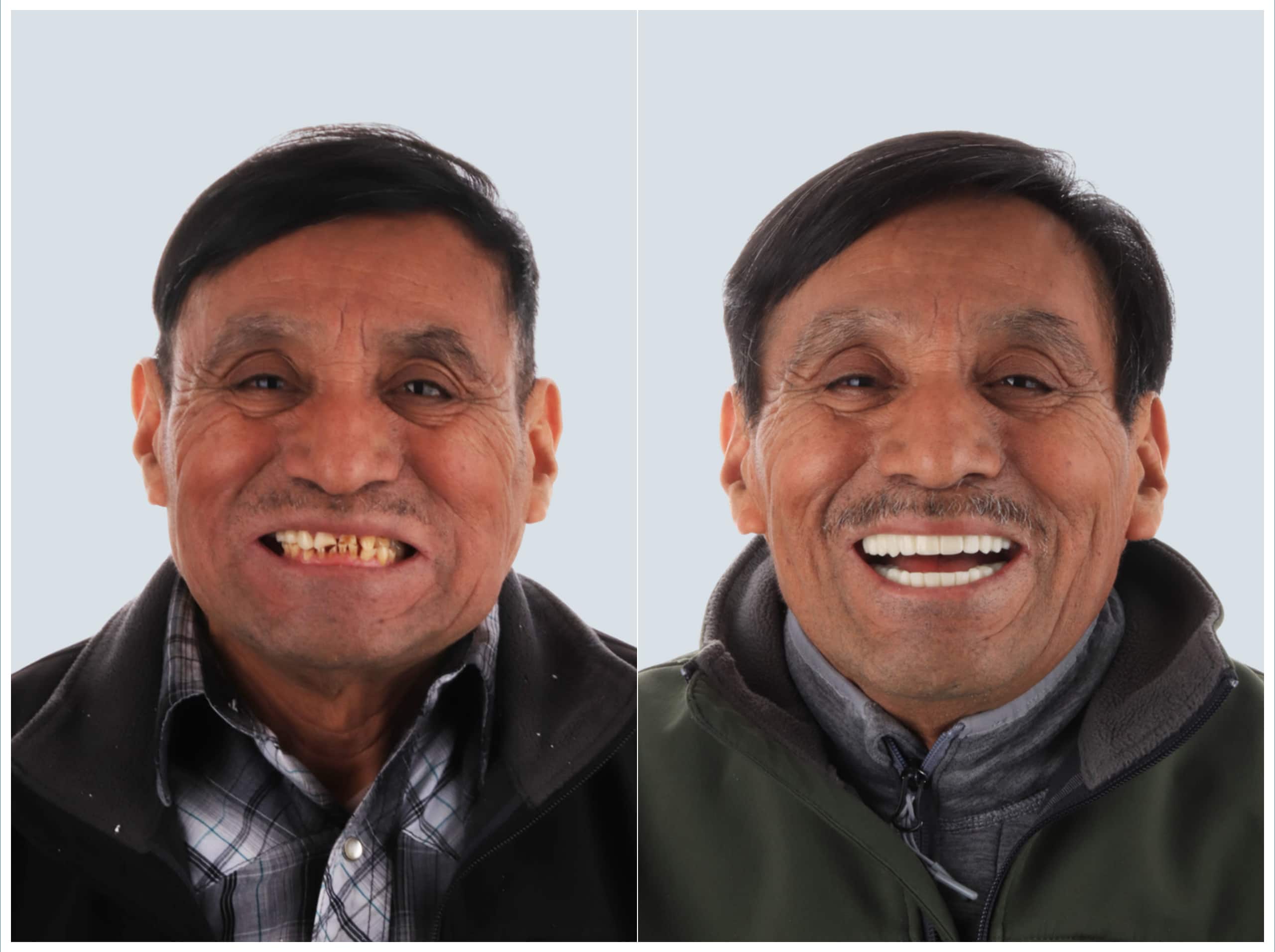 before and after2 (1)