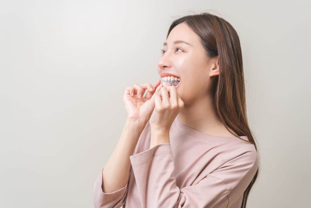 Do You Really Need to Wear Your Retainer Forever? What Adults Should Know
