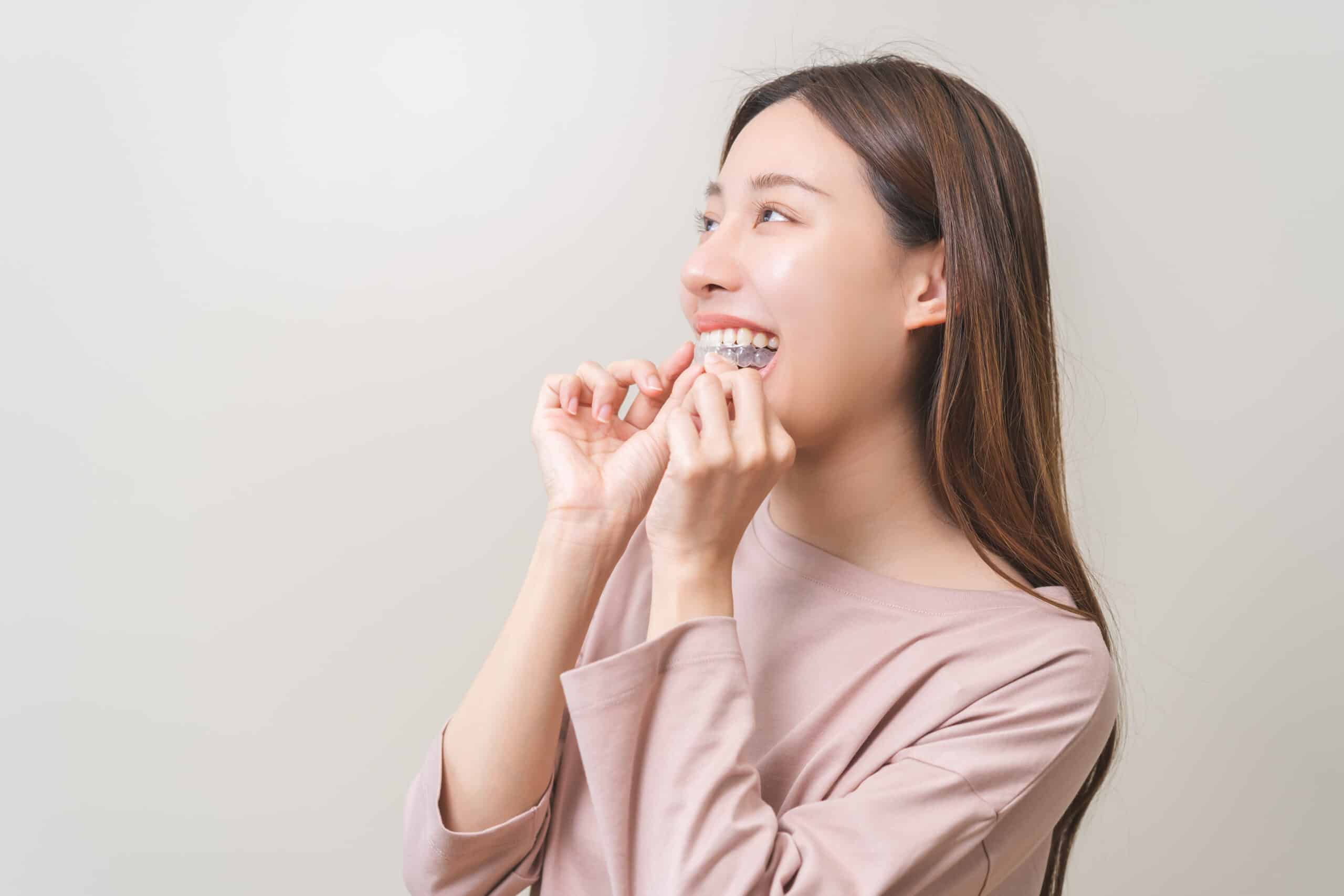 Do You Really Need to Wear Your Retainer Forever? What Adults Should Know