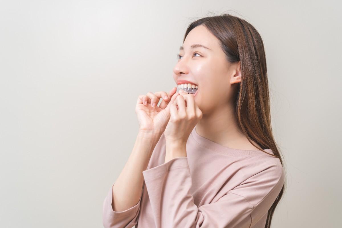 Do You Really Need to Wear Your Retainer Forever? What Adults Should Know